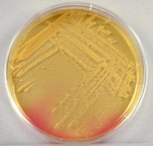 antibiotest_blog_44